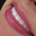 لمینت دندانپزشکی