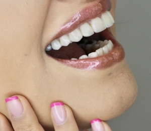 درمان زیبایی دندان