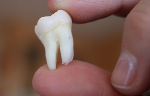 توصیه رعایت جراخی دندانپزشکی